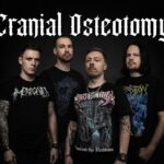 CRANIAL-OSTEOTOMY1