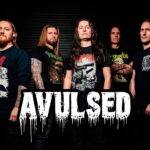 AVULSEDband1